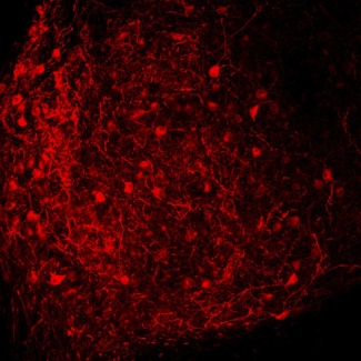 Red-fluorescent protein labeling cellular structure.