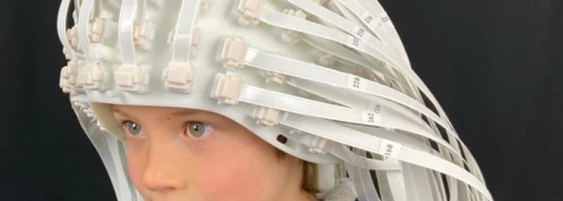 Child wears a helmet made up of more than 100 OPM sensors.